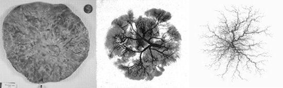 Left to right: typical human placenta; X-ray of the placental vasculature; model placental vascular tree.
